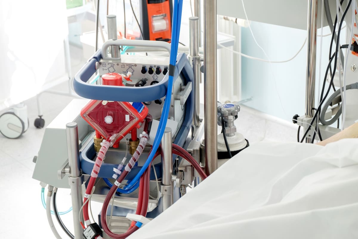 Una máquina de oxigenación por membrana extracorpórea funciona como un pulmón externo: le suma oxígeno a la sangre por fuera del cuerpo