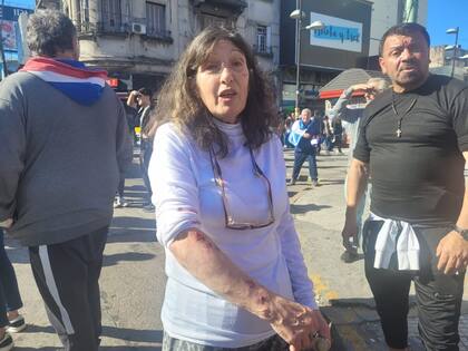 Una militante de LLA muestra las heridas que le dejó una agresión de una mujer en Lomas