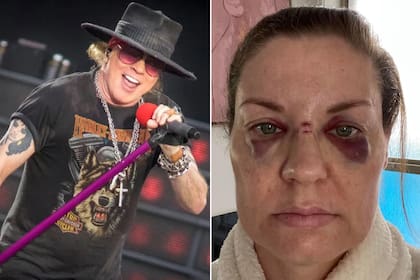 Una mujer acusa a Axl Rose de haberla lastimado en pleno recital de los Guns ‘N Roses