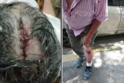 Una mujer atacó a un hombre a palazos por que le dijo que juntara la caca de su perro, la víctima terminó con severas heridas en su cabeza, fue en el barrio de Boedo