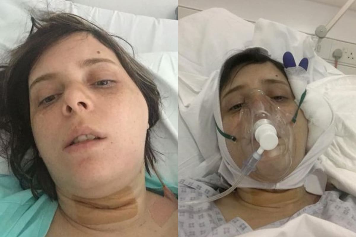 Una mujer británica experimentó una terrible pesadilla cuando compró una hamburguesa triple en KFC y se dislocó la mandíbula