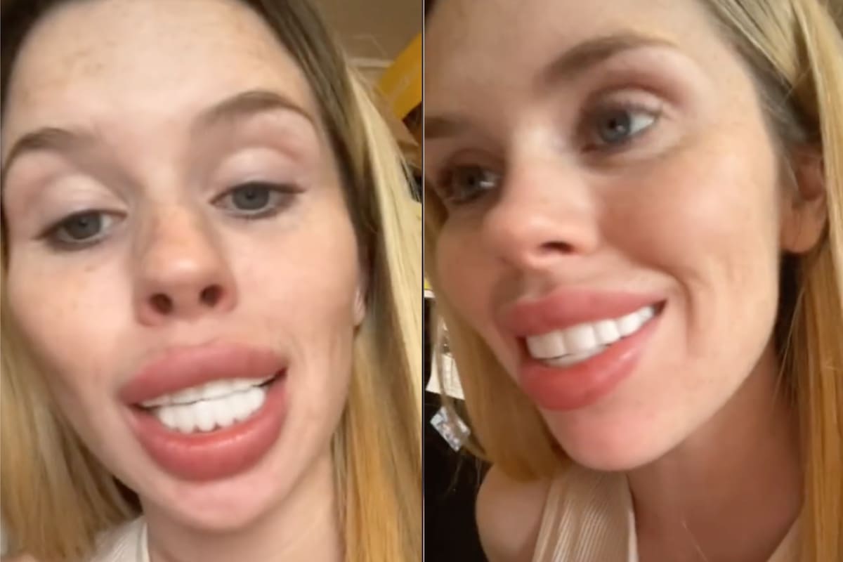 Una mujer compartió en TikTok los insólitos resultados de un diseño de sonrisa