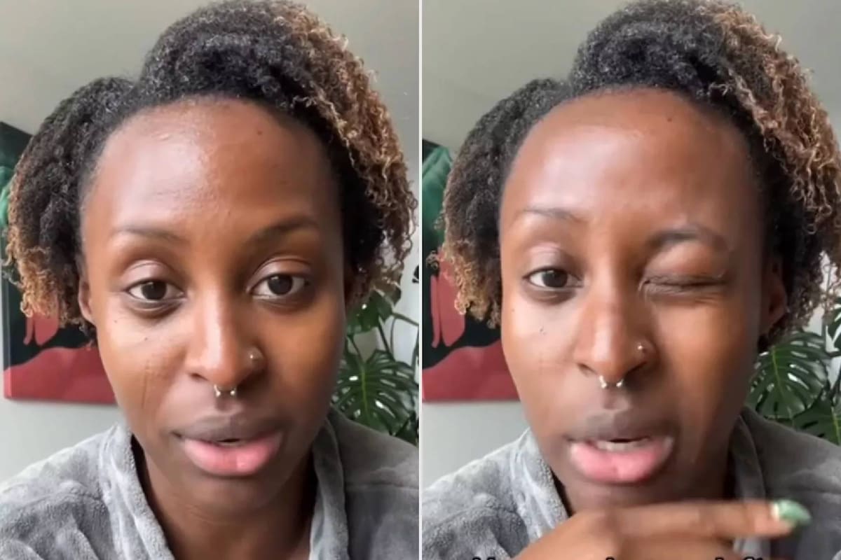 Una mujer contó los problemas oculares que le ocasionó mirar el eclipse sin gafas especiales