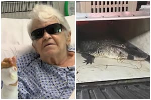 Una mujer de 84 años luchó contra un caimán para salvar a su mascota