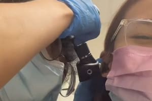 Una mujer en Singapur acudió a un hospital luego que una cucaracha le entre en su oído
Foto: captura de pantalla