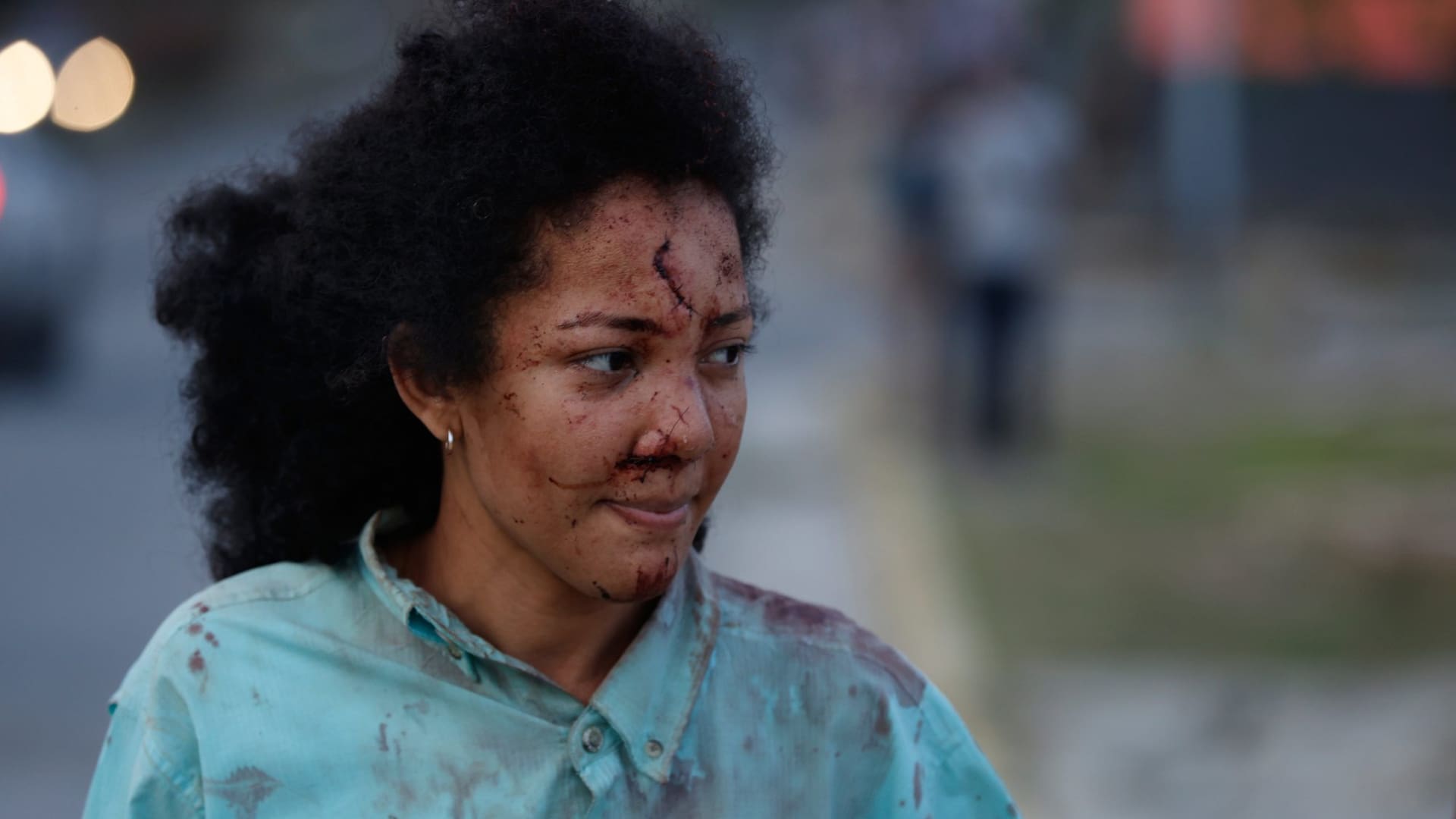 Una mujer herida camina en La Guaira, Venezuela, un día después de que un terremoto golpeara la zona