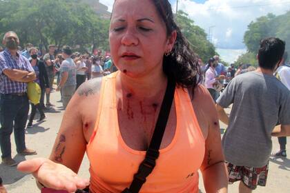 Una mujer herida por las balas de goma, en Formosa