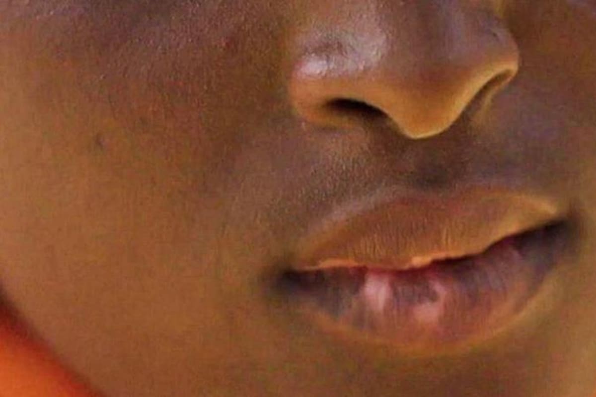 Una mujer nigeriana relató a la BBC los problemas de salud que presentan sus hijos por su decisión de intentar blanquearles la piel