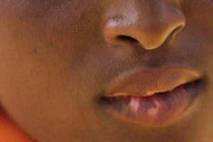 Una mujer nigeriana relató a la BBC los problemas de salud que presentan sus hijos por su decisión de intentar blanquearles la piel