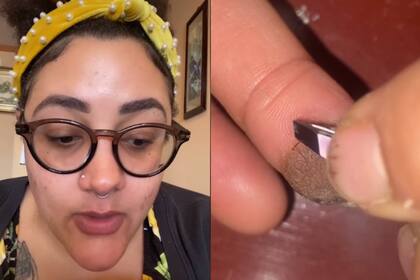 Una mujer norteamericana compartió varias imágenes en las redes sociales donde relata su inusual y extraño caso: comenzó a crecerle vello púbico en su dedo índice