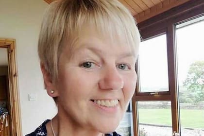 Una mujer reveló la rara enfermedad que padece y la publicación se hizo viral