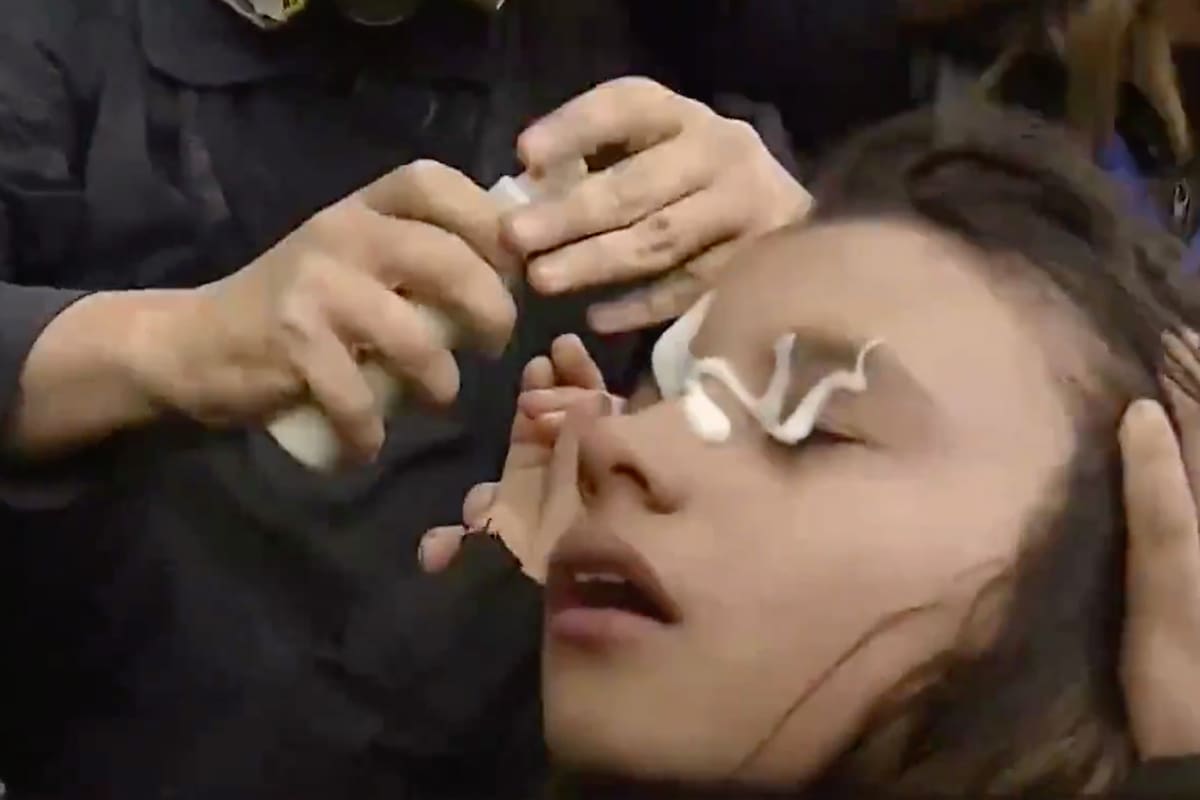 Una niña se ve afectada por gases lacrimógenos rociados por la policía antidisturbios durante una protesta frente al Congreso el 11 de septiembre de 2024.