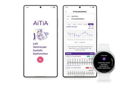 Una nueva función de monitoreo de la salud llegará a los relojes de Samsung