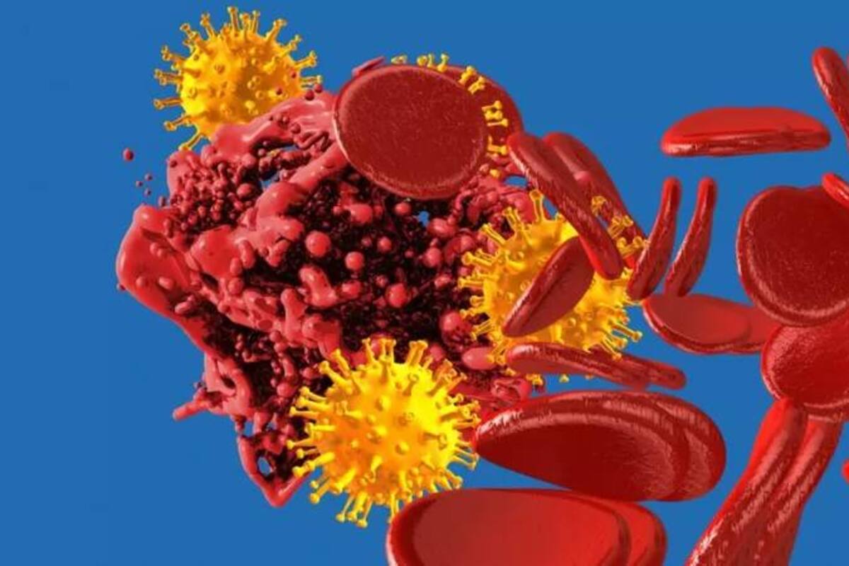 Una persona que haya padecido covid-19 tiene un mayor riesgo de desarrollar un coágulo de sangre grave en los seis meses siguientes de haber tenido la enfermedad