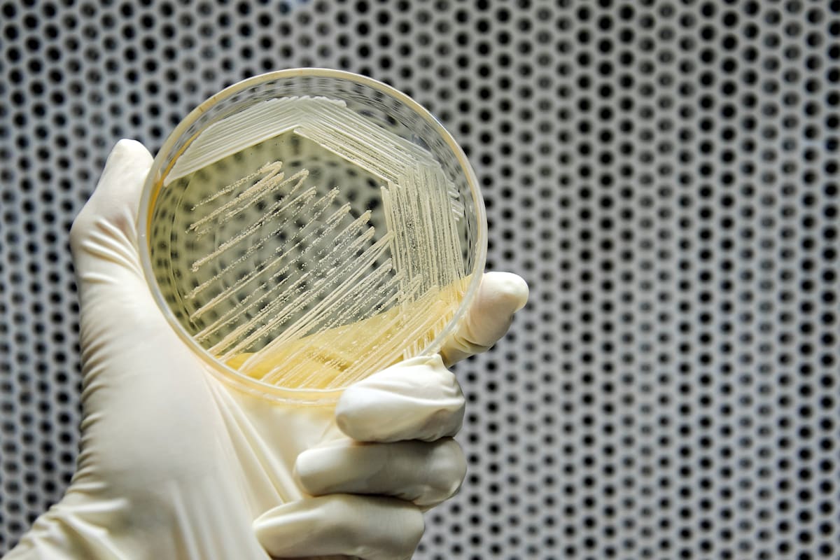 Una placa petri con muestras de "Saccharomyces cerevisiae"