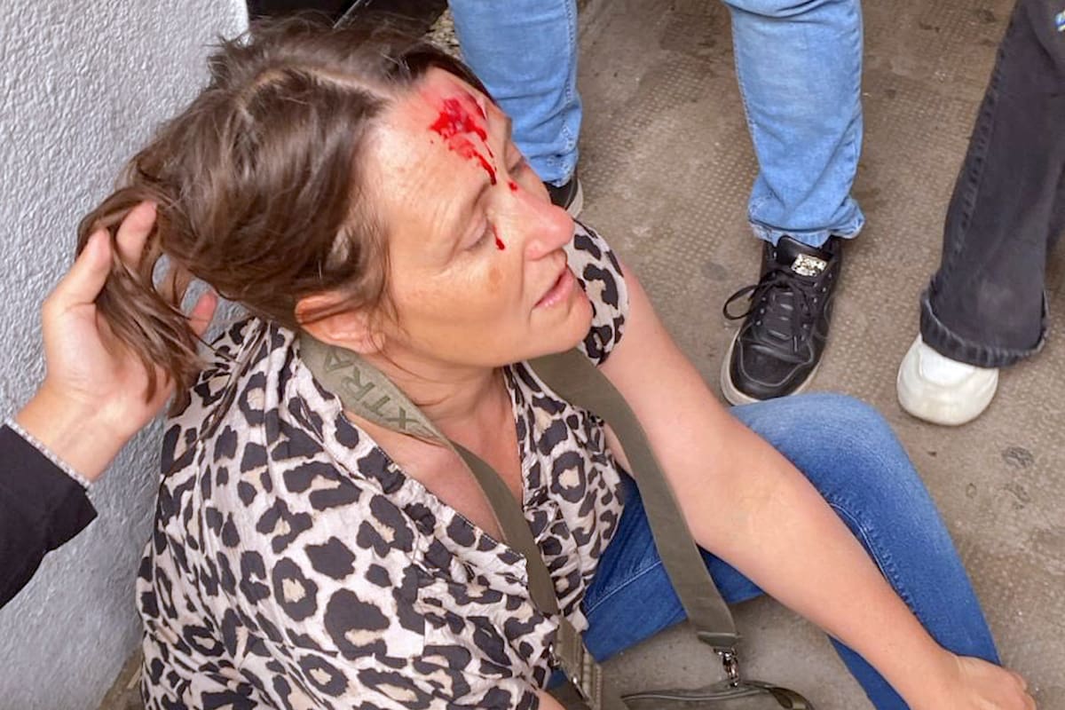 Una preceptora del Normal 2 terminó con un corte en la frente tras separar a dos alumnos durante una pelea en el patio del colegio