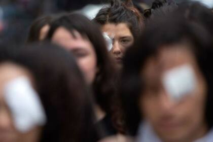 Una protesta de mujeres en Chile contra el uso de las balas de goma durante las manifestaciones