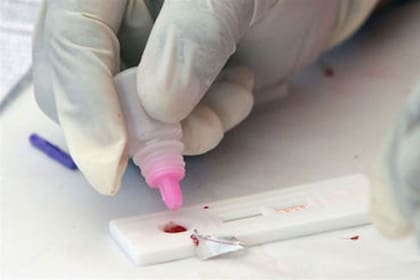 Una sola gota de sangre que se extrae del dedo es suficiente y en 10 minutos está el resultado