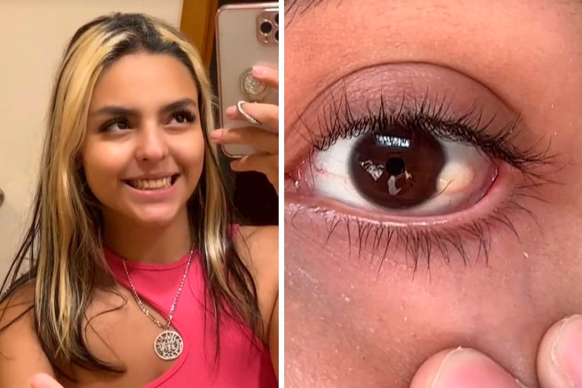 Una tiktoker muestra cómo se depila un pelo que le crece en el ojo