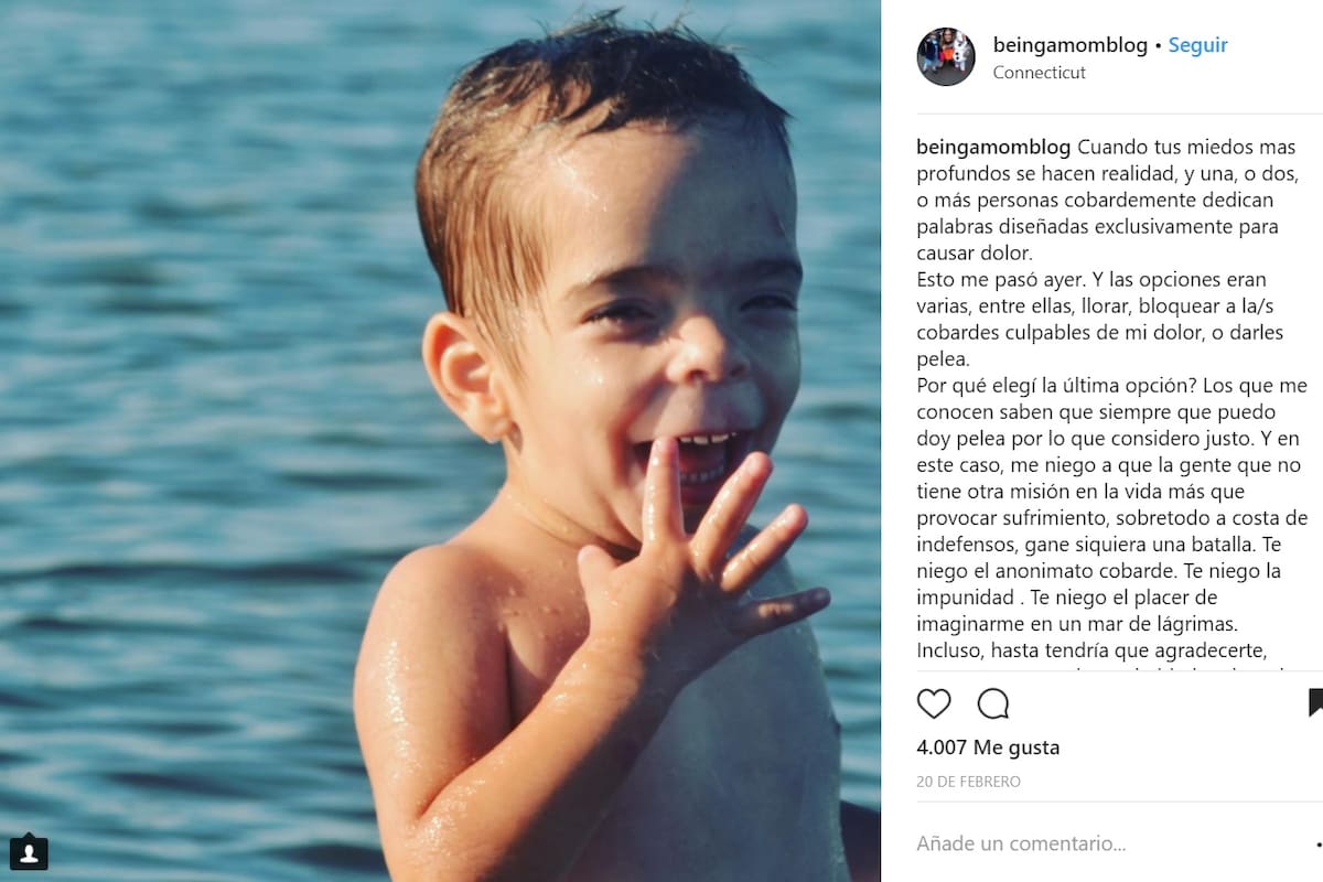 Una usuaria de la red social tildó de “horrible” a Juan, quien tiene 5 años y una extraña discapacidad que afecta su desarrollo físico y mental