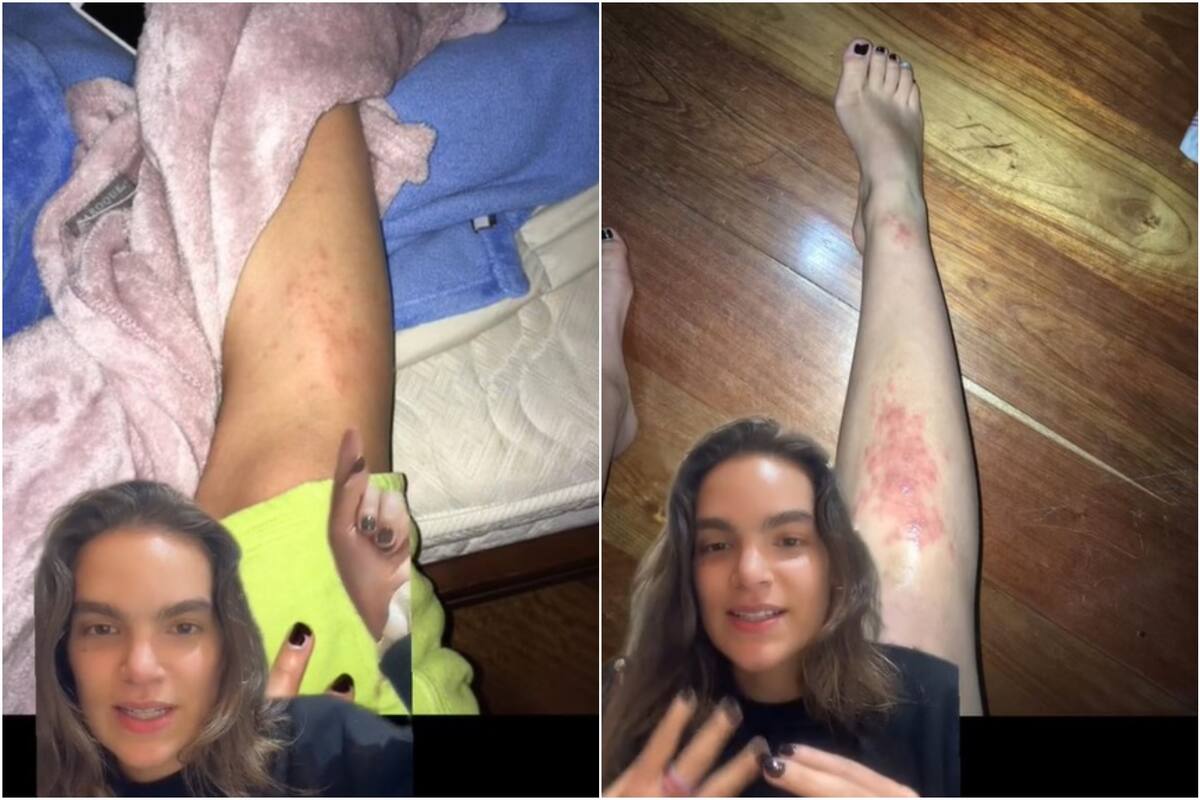 Una usuaria de TikTok contó cómo se le metió un parásito por el pie tras caminar descalza por la playa