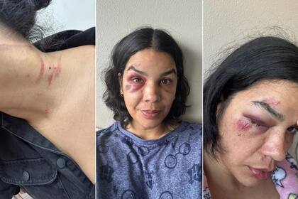 Una venezolana fue agredida en Houston, Texas