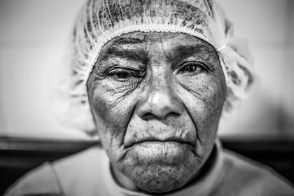 Unas 450 personas de diferentes localidades de Salta fueron operadas de cataratas durante cuatro días por un equipo de 50 profesionales en el Hospital materno infantil