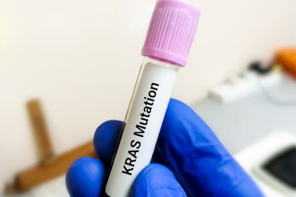 Uno de cada diez tumores está impulsado por mutaciones en el gen KRAS, descubierto en 1982