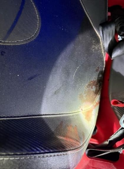 Uno de los asientos del UTV con manchas de sangre.