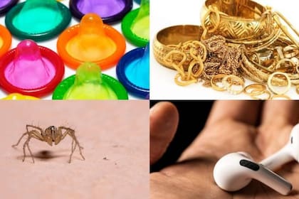 Uno de los casos también involucró la extracción de dos arañas del cuerpo de un niño estadounidense de nueve años