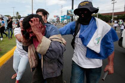Uno de los heridos durante la masiva protesta contra el gobierno de Ortega