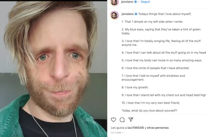 Uno de los tantos posteos de Jono Lancaster, hoy al frente de su propia fundación: Love Me Love My Face