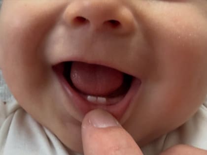 Úrsula Corberó mostró cómo le crecen los dientes a Dante