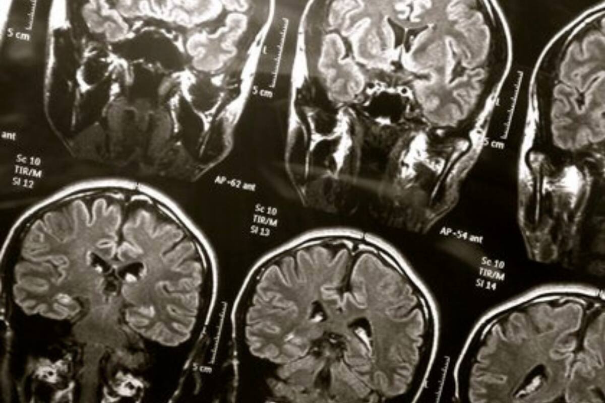 Utilizaron un algoritmo de aprendizaje automático para mapear qué regiones del cerebro se activan cuando las diferentes emociones se separan