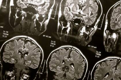 Utilizaron un algoritmo de aprendizaje automático para mapear qué regiones del cerebro se activan cuando las diferentes emociones se separan