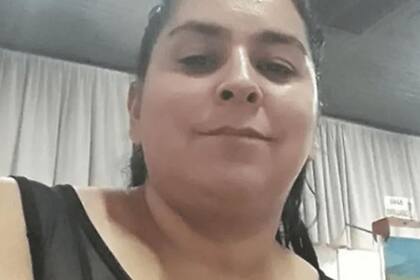 Vanesa Caro fue prendida fuego por su esposo y falleció este sábado, por complicación durante una traqueotomía