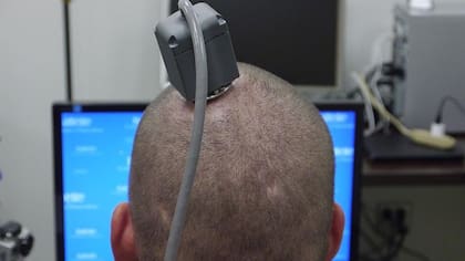 Varias empresas han incursionado sobre los potenciales usos médicos de los implantes de chips en el cerebro.