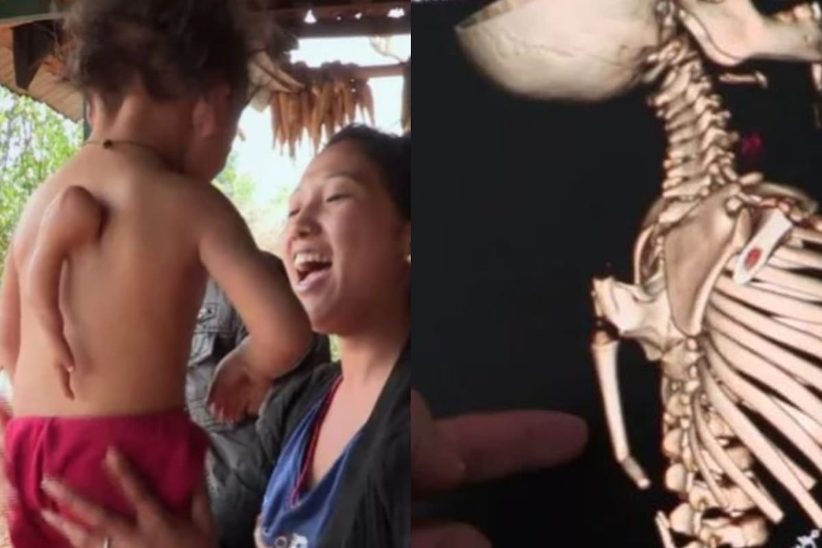 Vecinos le rendían homenajes, asumiendo que la causa de su condición era por algo divino (Pinterest)