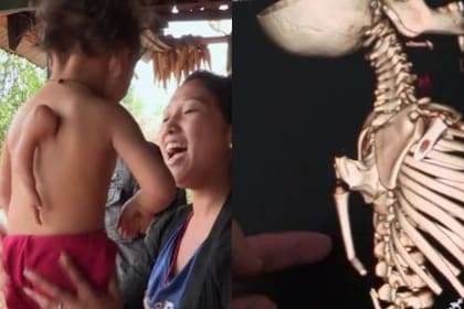 Vecinos le rendían homenajes, asumiendo que la causa de su condición era por algo divino (Pinterest)