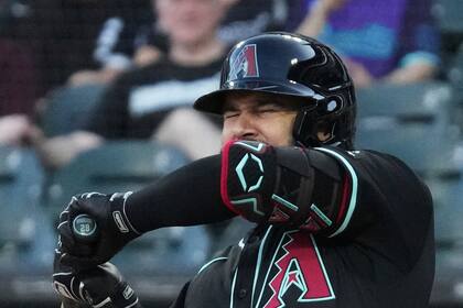 Venezolano Eugenio Suárez deja el juego de Arizona tras ser golpeado en la mano por un lanzamiento