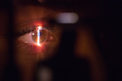 Vinculan gotas oculares con bacteria resistente; diversos casos documentan el calvario que sufrieron los pacientes