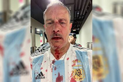 Violencia en Argentina - México en primera persona: el momento en que un hincha albiceleste fue golpeado por cuatro mexicanos