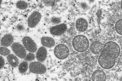 Viriones maduros de viruela del mono con forma ovalada, y viriones inmaduros con forma redonda, en una imagen de 2003 tomada por un microscopio de electrones y publicada por los Centros de Control y Prevención de enfermedades de los Estados Unidos,  (Cynthia S. Goldsmith, Russell Regner/CDC via AP)