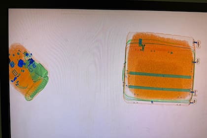 Visualización por escáner que permitió detectar la presencia de paquetes sospechosos en la valija y la mochila del pasajero proveniente de Roma
