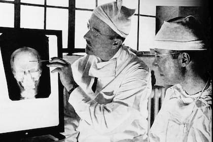 Walter Freeman, a la izquierda, y James Watts estudian una radiografía antes de una operación de lobotomía