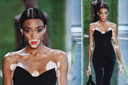 Winnie Harlow será parte de los ángeles de Victoria´s Secret