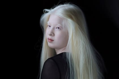 Xueli Abbing