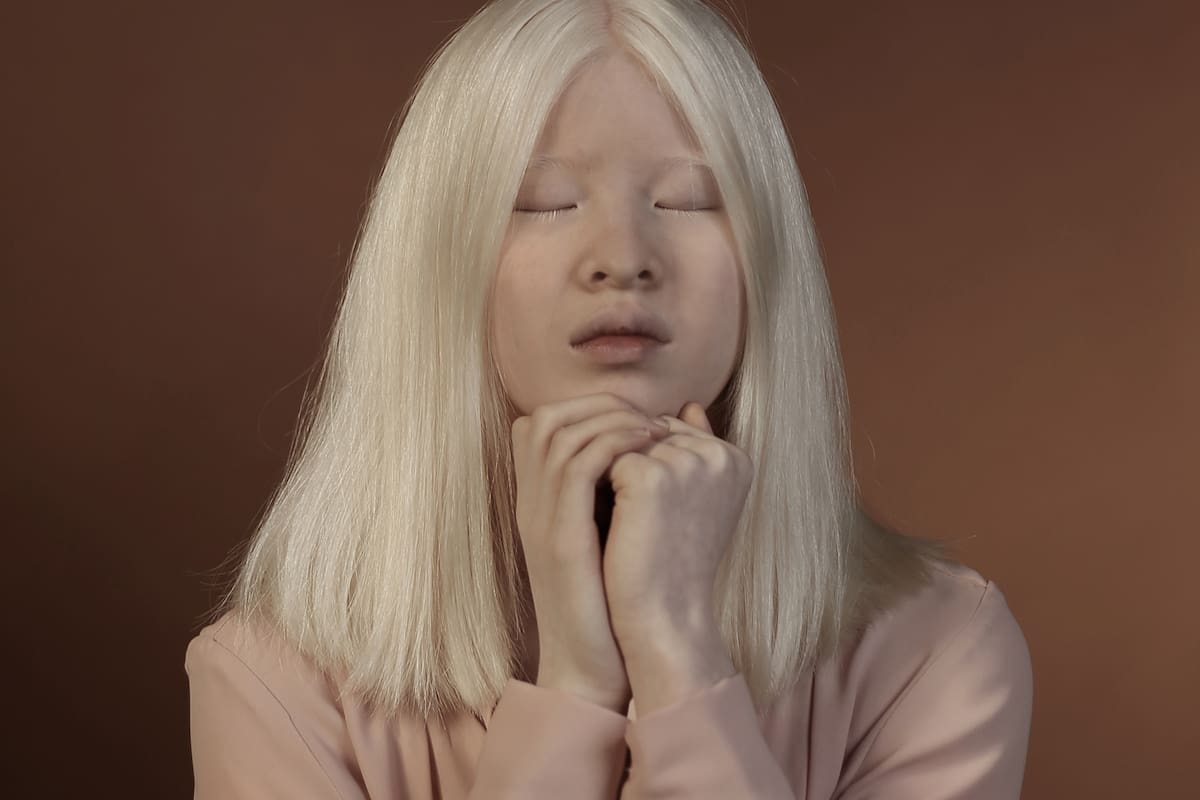 Xueli Abbing, la joven albina de China modelo de Vogue