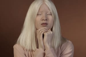 Xueli Abbing, la joven albina de China modelo de Vogue