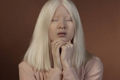 Xueli Abbing, la joven albina de China modelo de Vogue